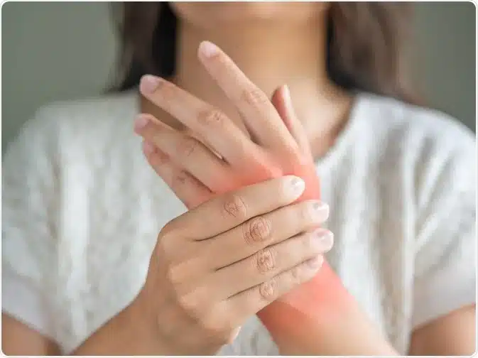 Causes, Symptoms, and Treatment Options for Fungal Arthritis